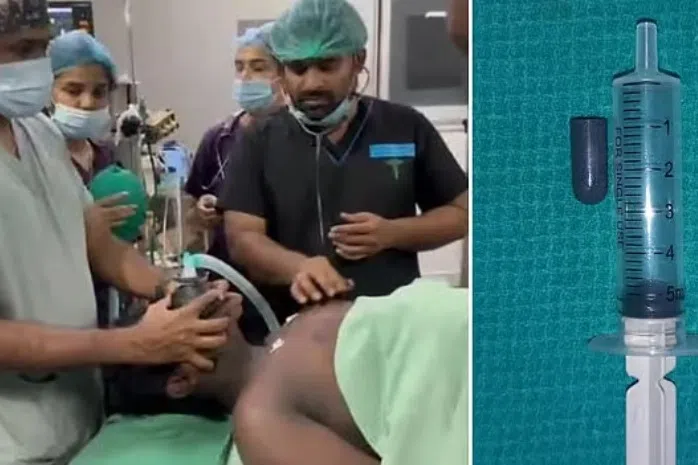 சிறுவனின் மூச்சுக்குழாயிலிருந்து பேனா மூடி அகற்றம்