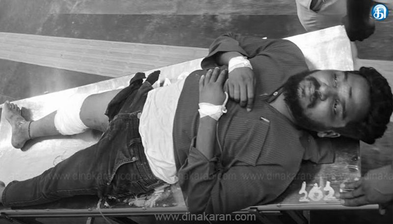 பொன்னேரி அரசு மருத்துவமனை பெண் ஊழியர் மீது தீ வைப்பு: இளைஞர் பிரகாஷ் போலீசாரால் சுட்டுப்பிடிப்பு!